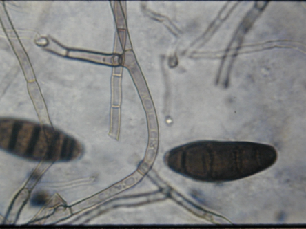 <ul><li><p>Large spores (conidium)</p></li><li><p>y-branching </p></li><li><p>Crosswalls</p></li></ul><p></p>