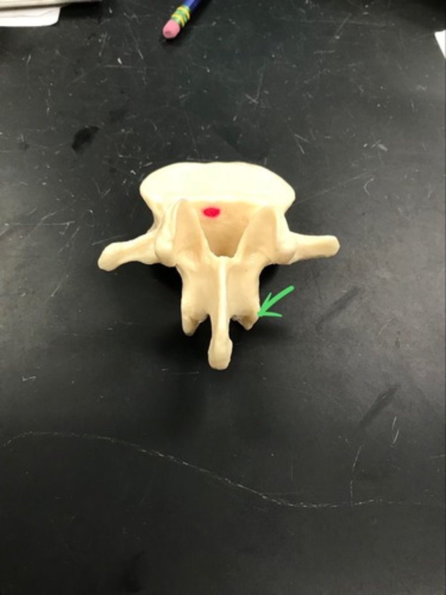 <p>- Contains the inferior articular facet</p>