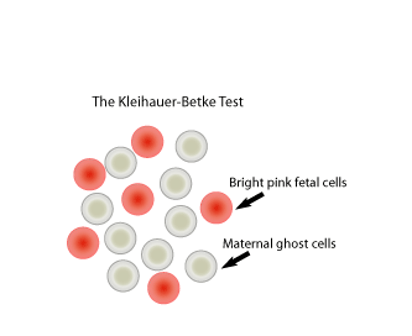 <p>% Hgb F = (total # of fetal cells/500) x 100</p>