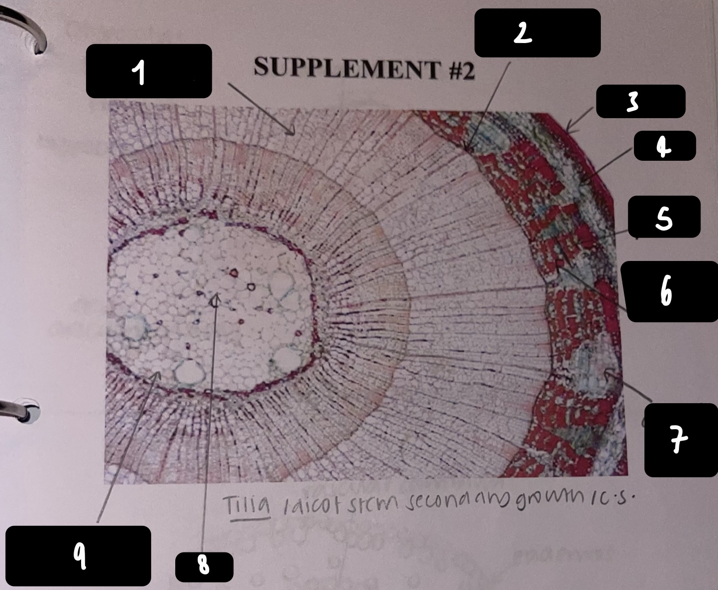 <p>name the structure in label 1</p>