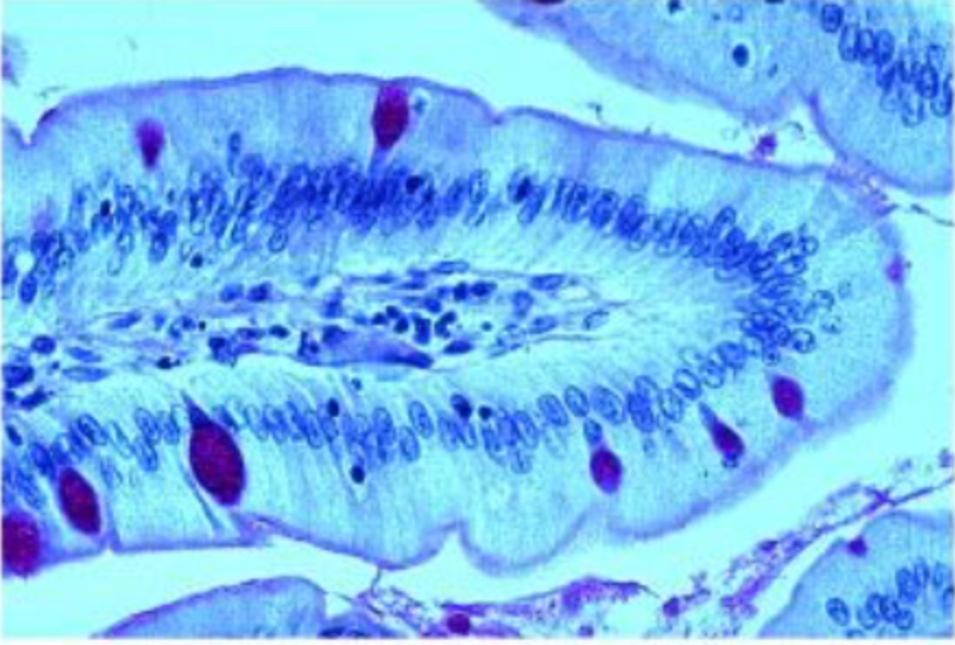 <p>simple columnar</p>