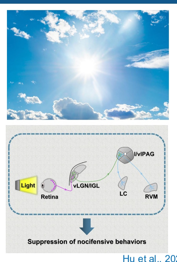 <ul><li><p>Bright light can have antinociceptive effects</p></li><li><p>Visual pathway via portion of the LGN (ventral lateral geniculate nucleus and intergeniculate leaflet) ➔ PAG ➔ regions involved in pain regulation (locus Coeruleus, LC; rostral ventromedial medulla, RVM)</p></li><li><p><strong>Bright light can reduce pain (antinociception):</strong></p><ul><li><p>Exposure to&nbsp;<strong>bright light</strong>&nbsp;can&nbsp;<strong>dampen or block pain signals</strong>&nbsp;— this is called an&nbsp;<strong>antinociceptive effect</strong>&nbsp;(anti = against, nociception = pain sensing).</p></li></ul></li><li><p><strong>How light reduces pain — the brain pathway:</strong></p></li></ul><ol><li><p><strong>Light is detected by your eyes</strong>, and the signal travels along your&nbsp;<strong>visual pathways</strong>.</p></li><li><p>Instead of going to the parts of the brain that process images,&nbsp;<strong>some light signals are sent to a special part of the thalamus</strong>&nbsp;called the&nbsp;<strong>ventral lateral geniculate nucleus (vLGN)</strong>&nbsp;and the&nbsp;<strong>intergeniculate leaflet (IGL)</strong>.</p></li><li><p>From there, the signal is passed on to the&nbsp;<strong>periaqueductal gray (PAG)</strong>&nbsp;— an area deep in the brain that’s known for&nbsp;<strong>controlling pain</strong>.</p></li><li><p>The PAG then sends signals to other key&nbsp;<strong>pain control centers</strong>:</p><ul><li><p>The&nbsp;<strong>locus coeruleus (LC)</strong>&nbsp;— involved in alertness and stress responses.</p></li><li><p>The&nbsp;<strong>rostral ventromedial medulla (RVM)</strong>&nbsp;— which can&nbsp;<strong>inhibit pain signals</strong>&nbsp;in the spinal cord.</p></li></ul></li></ol><p></p>