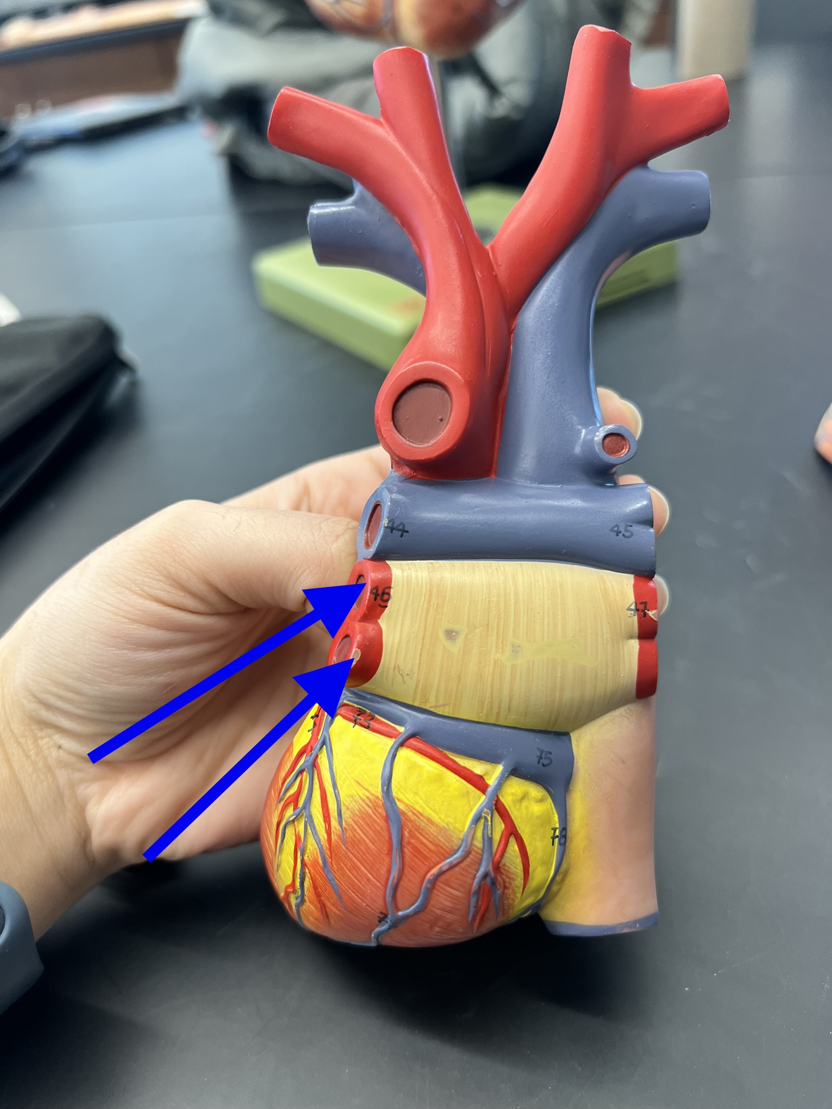 Name the heart structure.