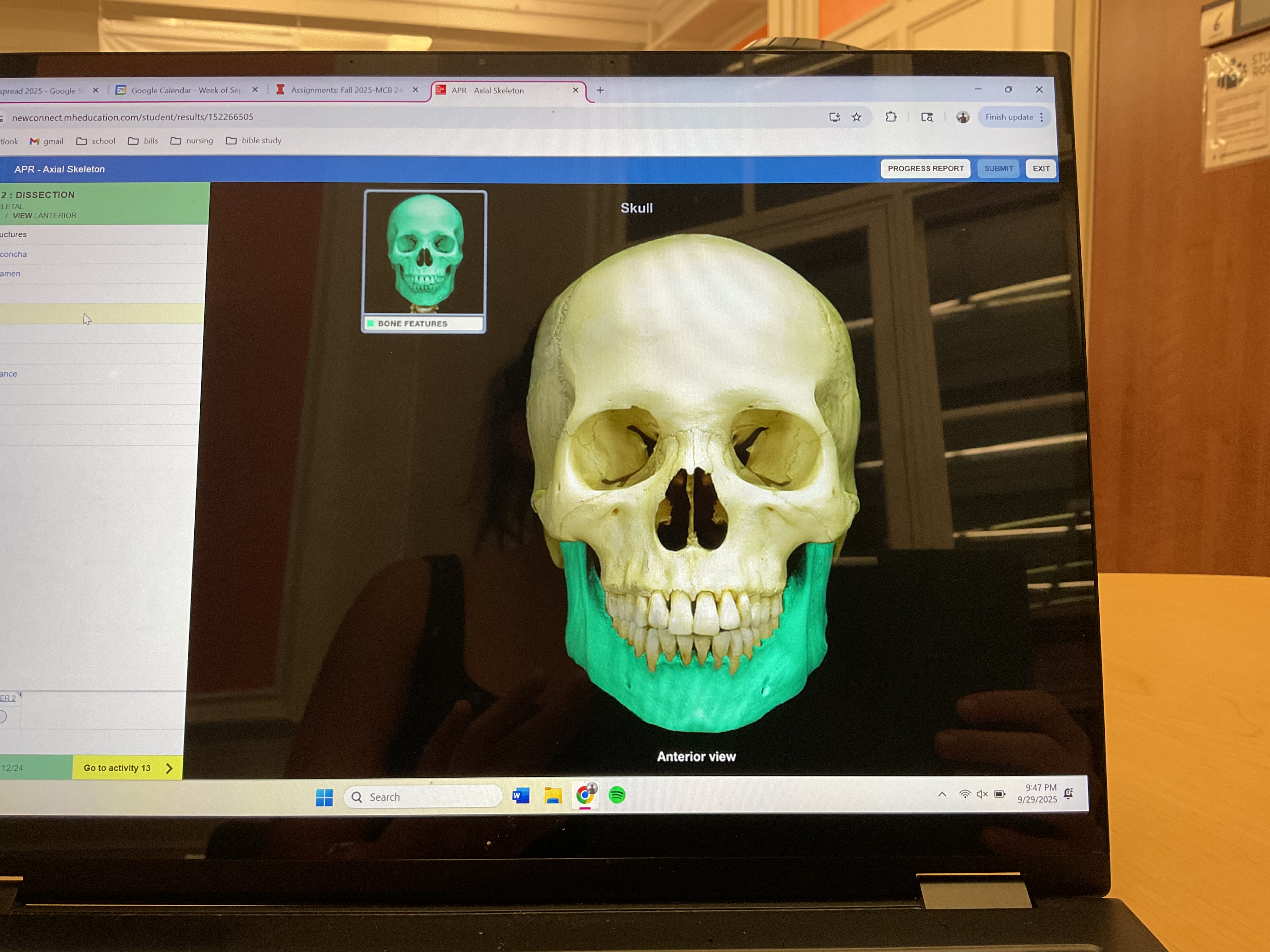 <p>Mandible </p>