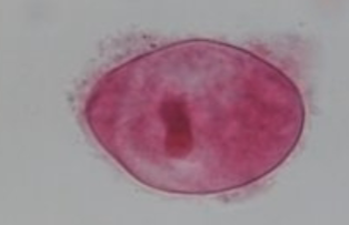 <p>MOT: Fecal / oral - ingestion of cyst</p><p>Infective Stage: Cyst</p><p>Hosts: Humans & other animals</p><p>Animal reservoir - primates, rodents, & pigs</p><p>Parts to look for: large kidney bean-shaped nucleus</p>