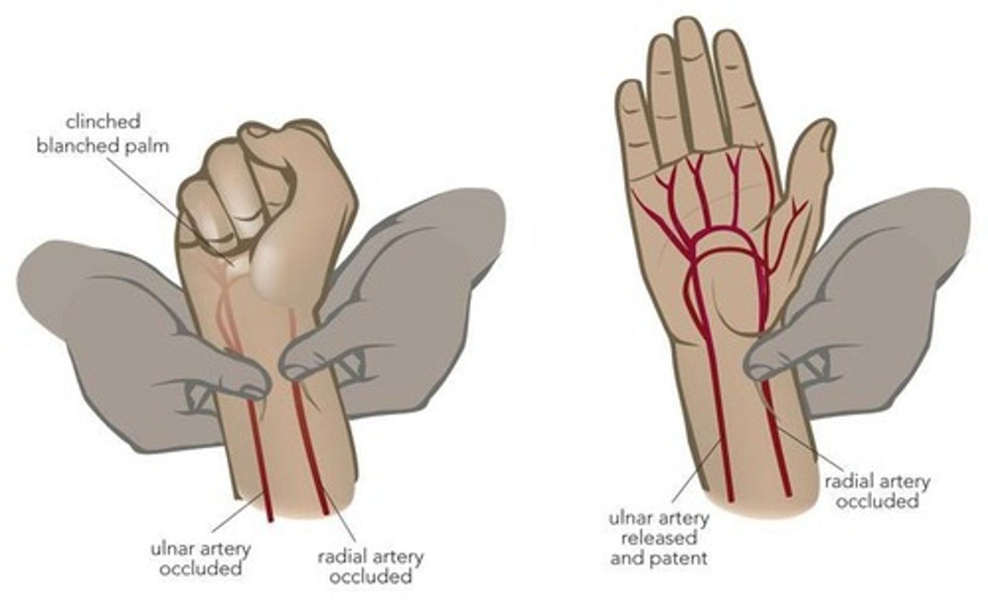 <p>Assesses arterial supply to the hand.</p>