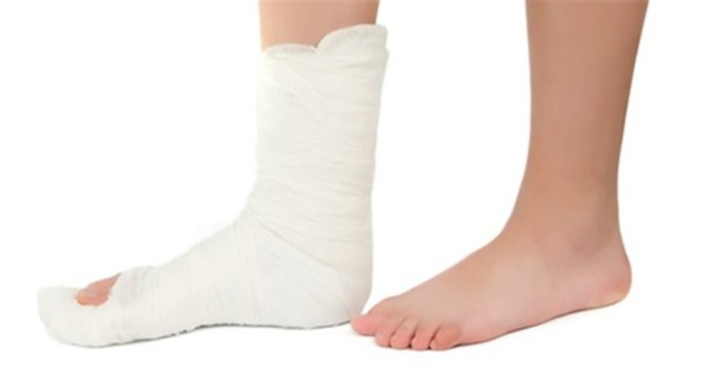 <p>to break your foot</p>