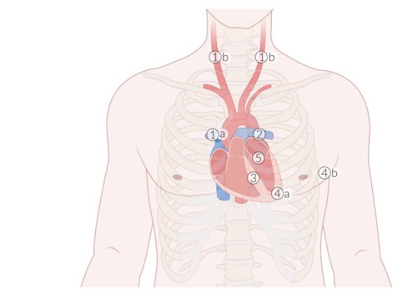 <p>auscultation site 5</p>