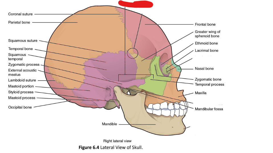 term image