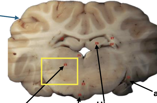 <p>What is this highlighted figure?</p>