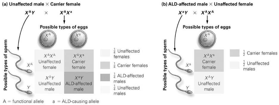 <p><span style="font-family: &quot;Times New Roman&quot;; font-size: 16px;">According to the Punnett square diagram, what percentage of possible male offspring could have adrenoleukodystrophy (ALD) if the father has ALD and the mother is unaffected?</span></p><p><span style="font-family: &quot;Times New Roman&quot;; font-size: 16px;">A)</span><span style="font-family: &quot;Times New Roman&quot;; font-size: 9.33px;">&nbsp; </span><span style="font-family: &quot;Times New Roman&quot;; font-size: 16px;">0%</span></p><p><span style="font-family: &quot;Times New Roman&quot;; font-size: 16px;">B)</span><span style="font-family: &quot;Times New Roman&quot;; font-size: 9.33px;">&nbsp; </span><span style="font-family: &quot;Times New Roman&quot;; font-size: 16px;">25%</span></p><p><span style="font-family: &quot;Times New Roman&quot;; font-size: 16px;">C)</span><span style="font-family: &quot;Times New Roman&quot;; font-size: 9.33px;">&nbsp; </span><span style="font-family: &quot;Times New Roman&quot;; font-size: 16px;">50%</span></p><p><span style="font-family: &quot;Times New Roman&quot;; font-size: 16px;">D)</span><span style="font-family: &quot;Times New Roman&quot;; font-size: 9.33px;">&nbsp; </span><span style="font-family: &quot;Times New Roman&quot;; font-size: 16px;">75%</span></p>