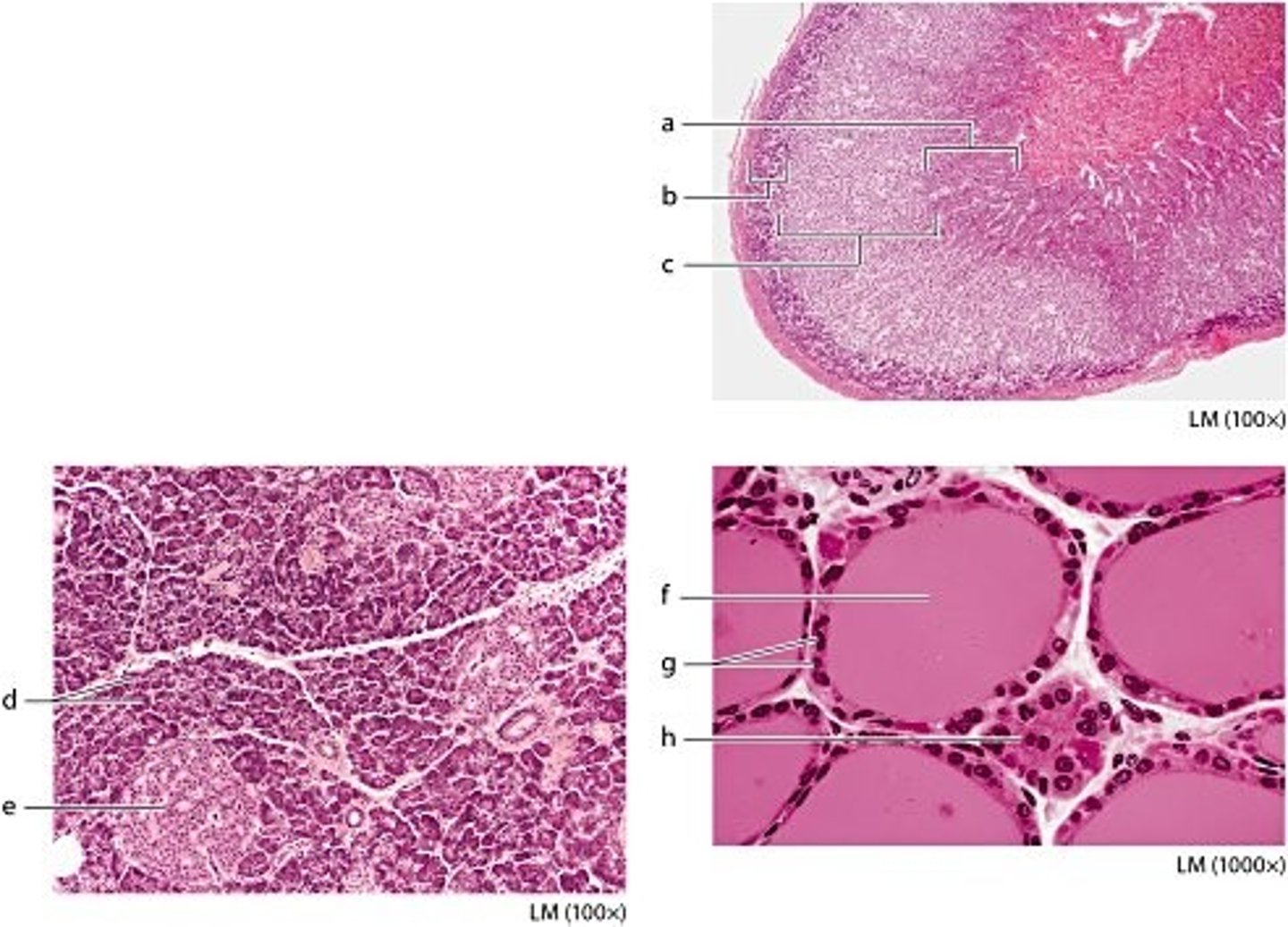 <p>zona reticularis</p>