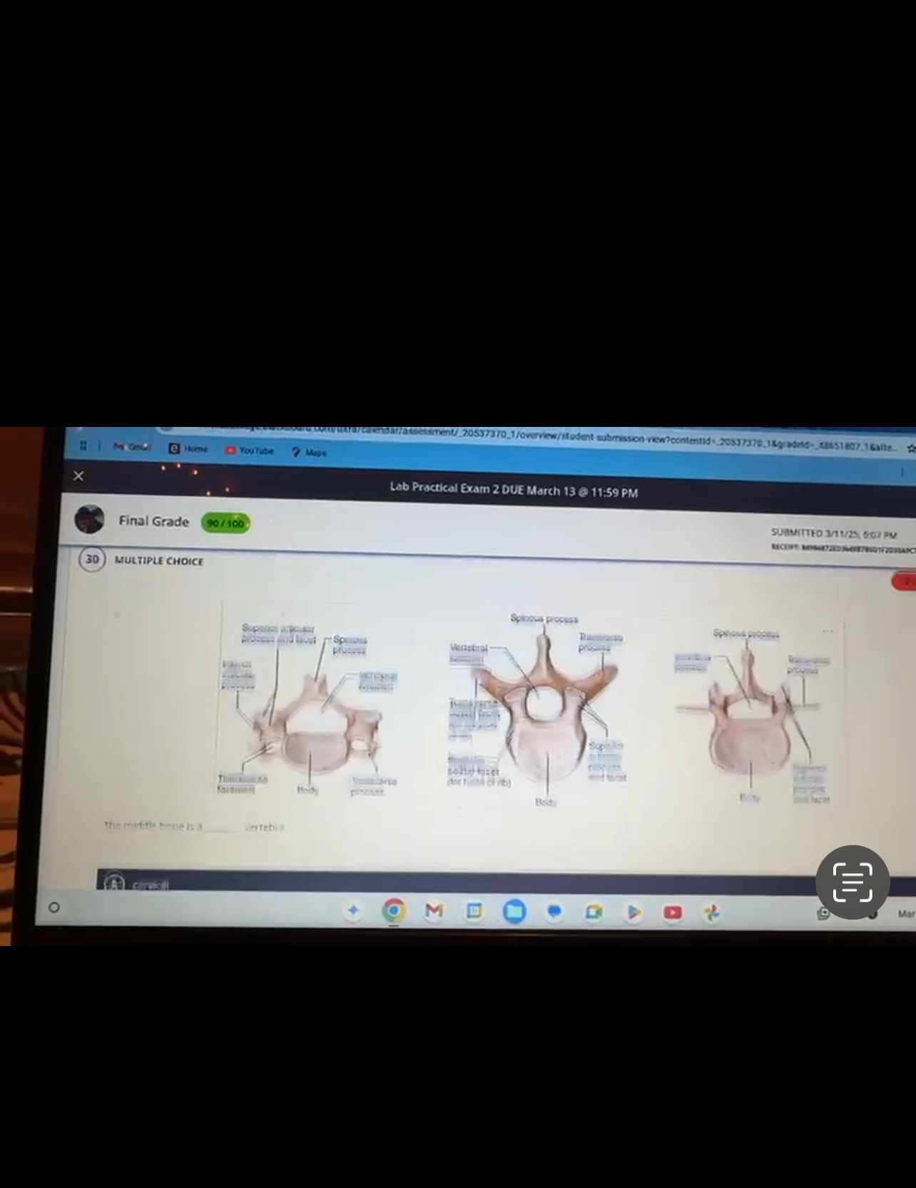 <p>middle bone is a ____ vertebra</p>