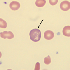 <p>What is the color of this erythrocyte?</p>