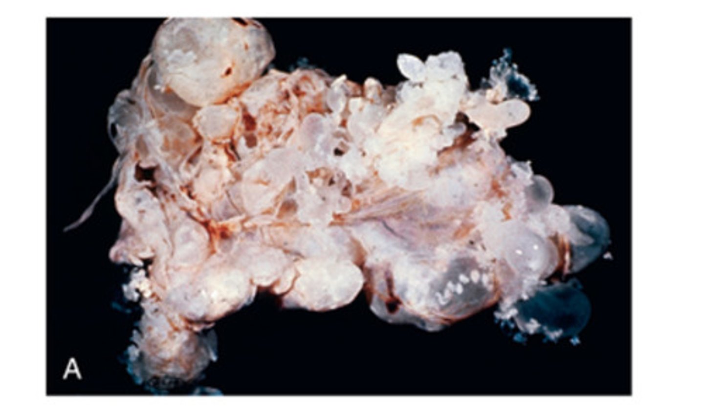 <p>Taenia serialis produces a coenrus stage in the CT of the rabbit intermediate host. This stage has a genus/species or scientific name. What is that name?</p>