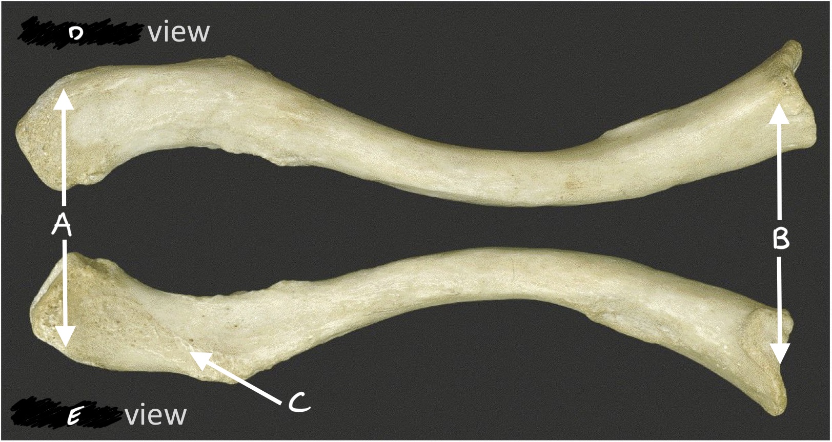 <p>B</p>