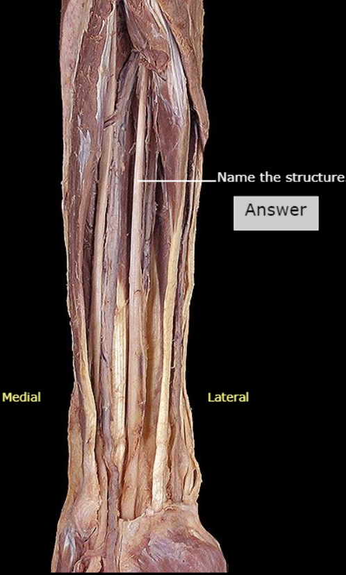 <p>What nerve is this</p>