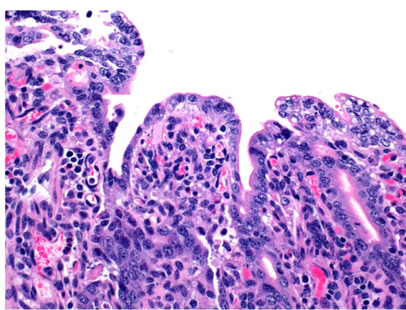 <p>Calf. What is the etiology?</p><p>A-Bovine coronavirus</p><p>B-Bovine viral diarrhea virus</p><p>C-Ovine herpesvirus type 2</p><p>D-Bovine astrovirus</p>