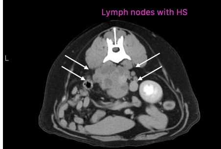 <p>-multi-organ</p><p>-<strong>LNs, liver, lung, spleen</strong> most common</p>