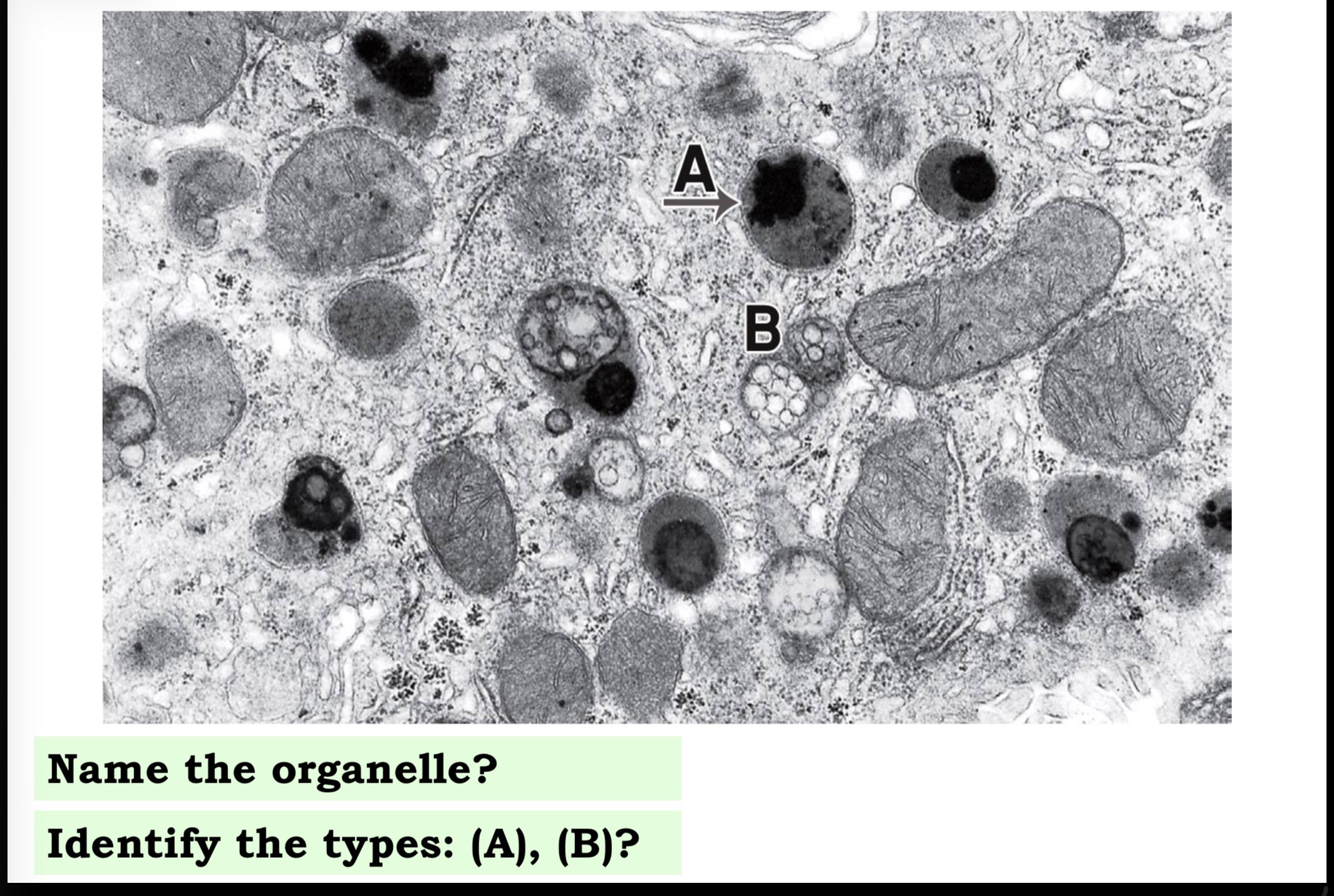 <p>Answer the questions in these following pictures</p>