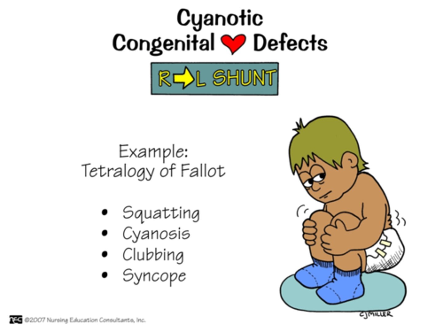 <p>Right‑to‑left shunts (e.g., Tetralogy of Fallot, tricuspid or pulmonary atresia) send poorly oxygenated blood to the body, causing visible cyanosis because too little blood reaches the lungs.</p><p>Types: </p><p>1. Decreased Pulmonary Blood Flow</p><p>2. Mixed Defects </p>