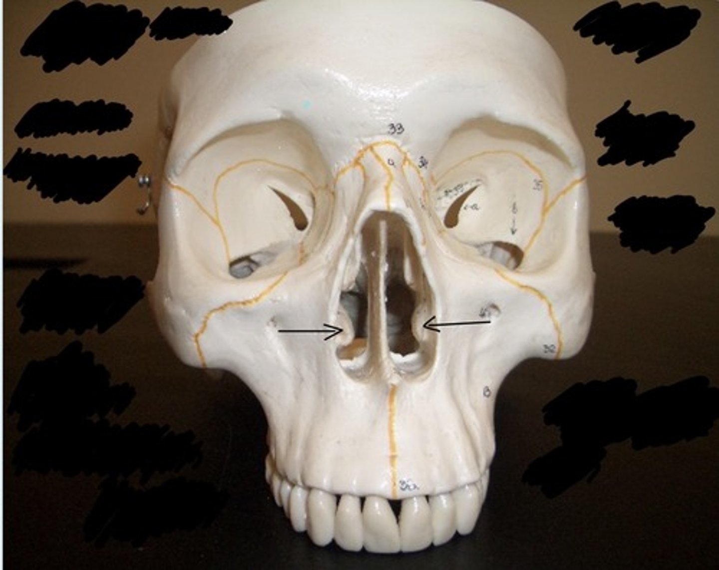 <p>What structure is pointed to here?</p>