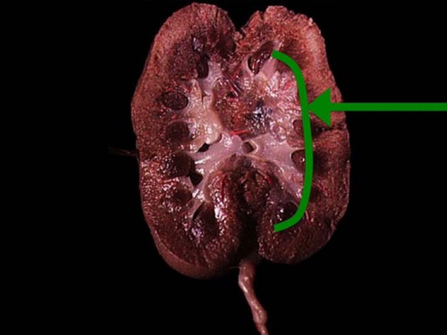 <p>Inner portion of the kidney.</p>