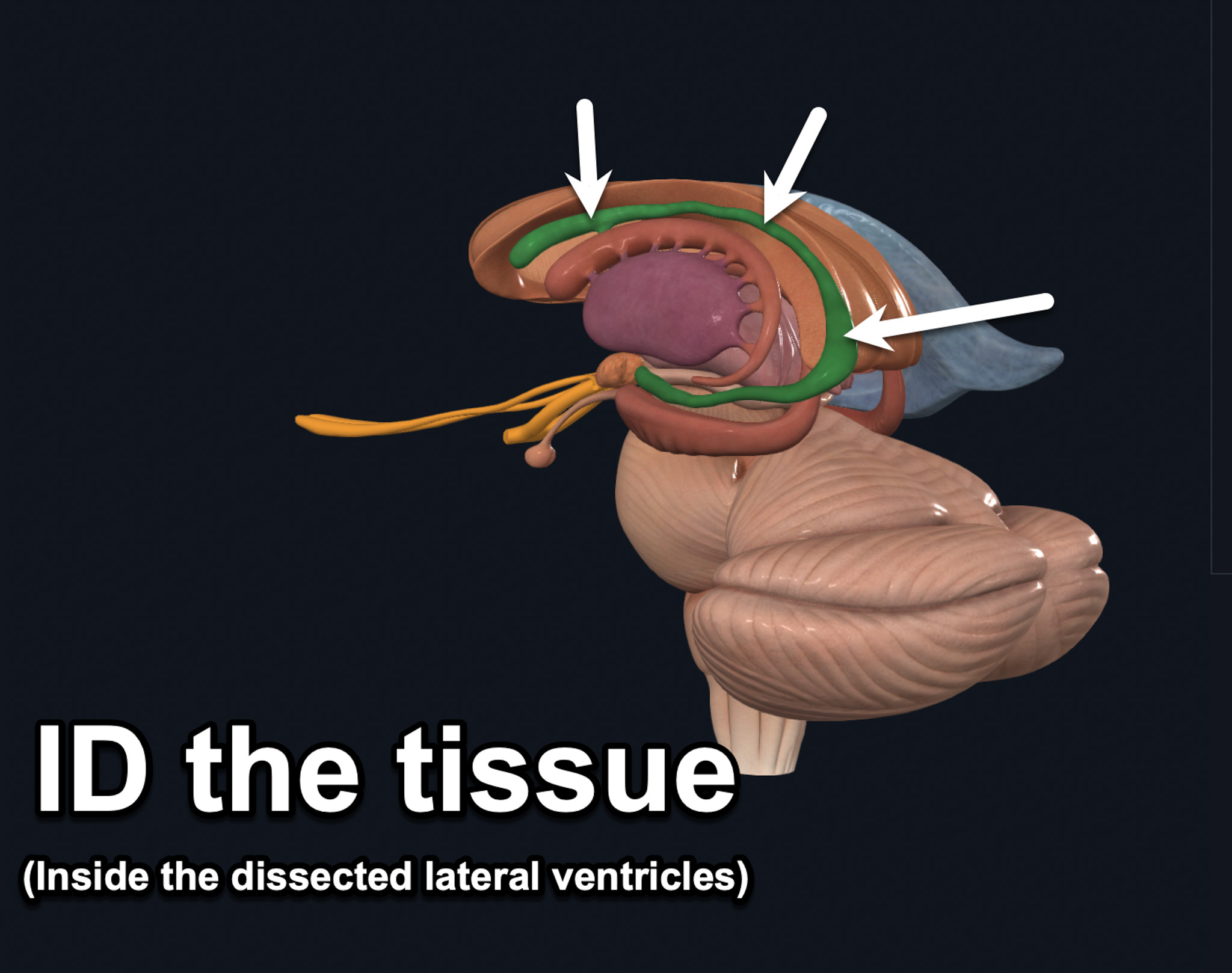 term image