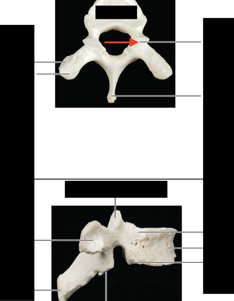 <ul><li><p>has flat surface </p></li></ul>