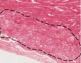 <p>what contractile structure of the heart?</p>