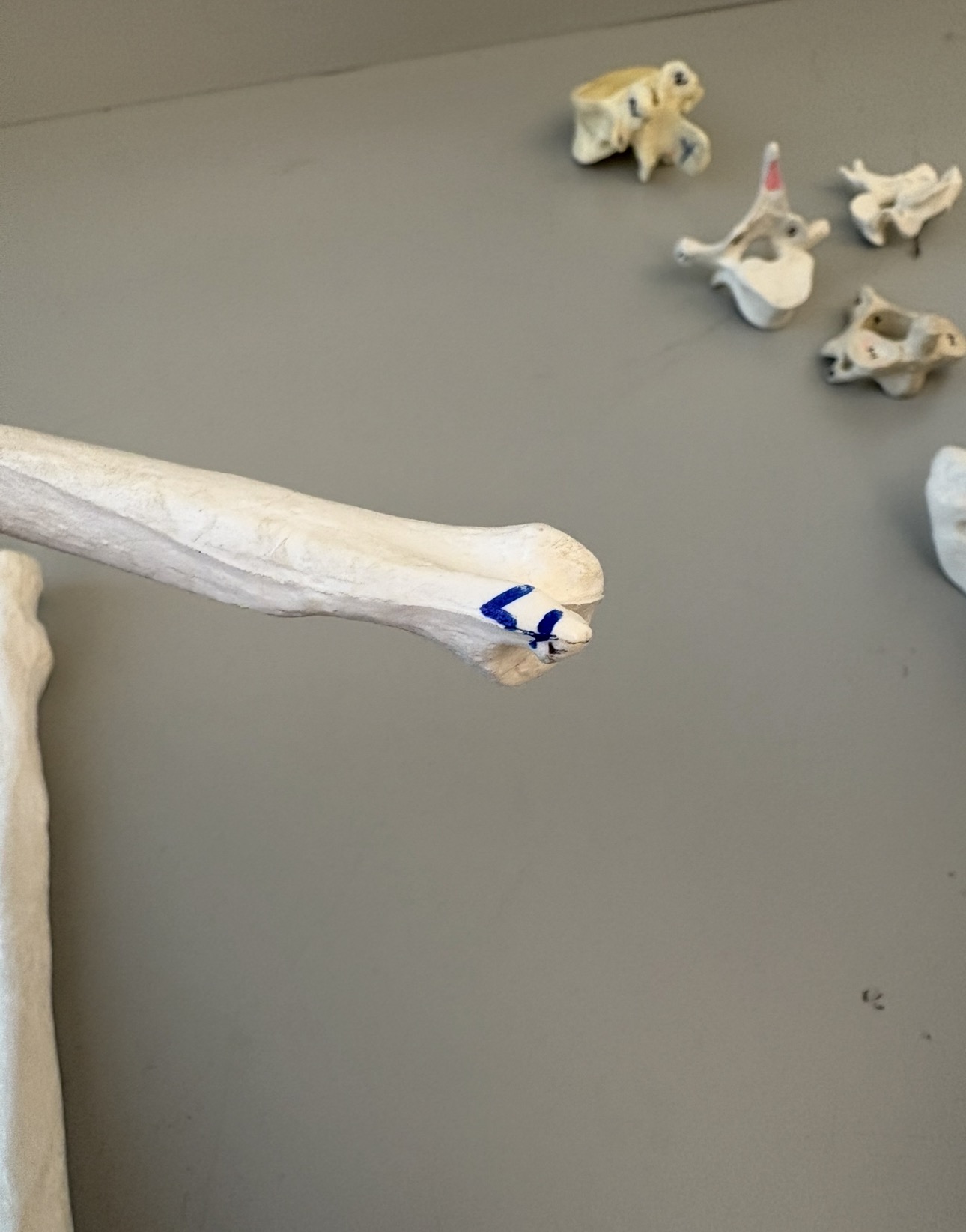 <p>what is 17 of ulna?</p>