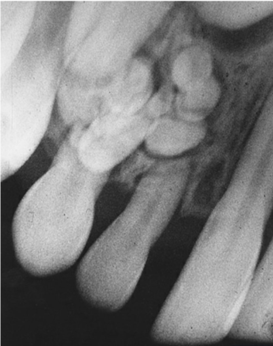 <p>resembles small teeth (toothlets/denticles)</p>