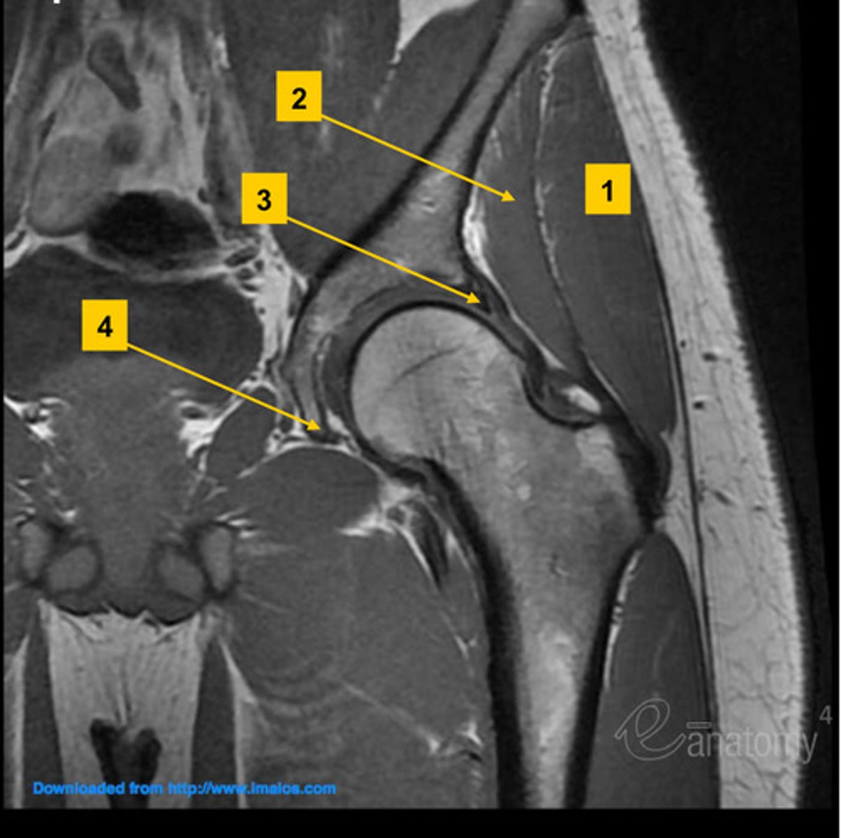 <p>- bilateral comparison hip joints<br>- acetabulum<br>- femoral head neck and shaft<br>- SI joints, sacrum, greater and lesser trochanter</p>