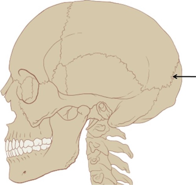 <p>Name this suture.</p>