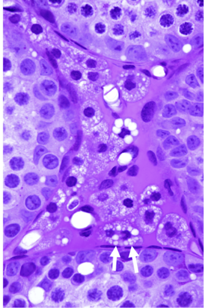 <p>What cell are the arrows pointing to?</p>