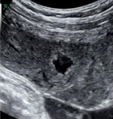 <p>Placental lakes</p>