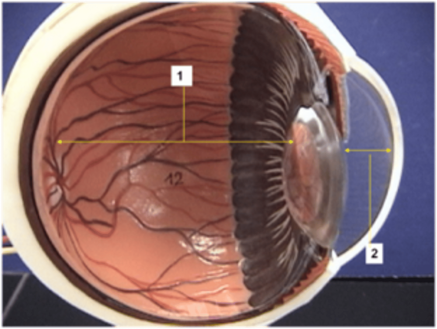 <p>Gel-filled space between lens and retina</p>