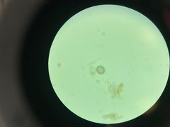 <p>What is the genus species of this tapeworm egg? It is the smallest cestode of the family Taeniidae</p>