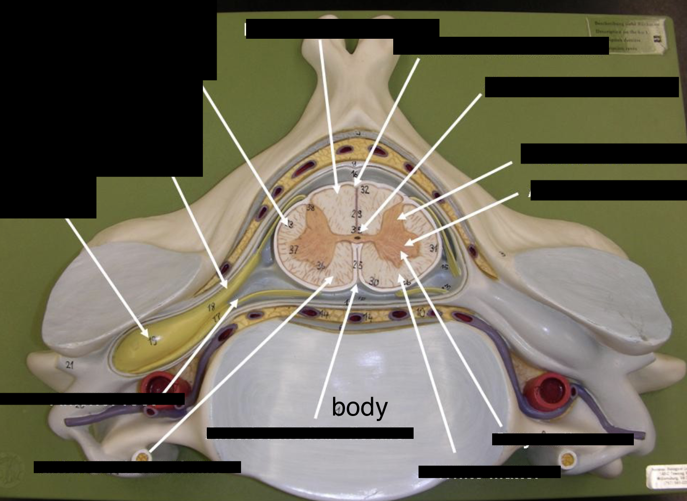 <p>what is this part of the vertebrae (of the spinal cord?) </p>