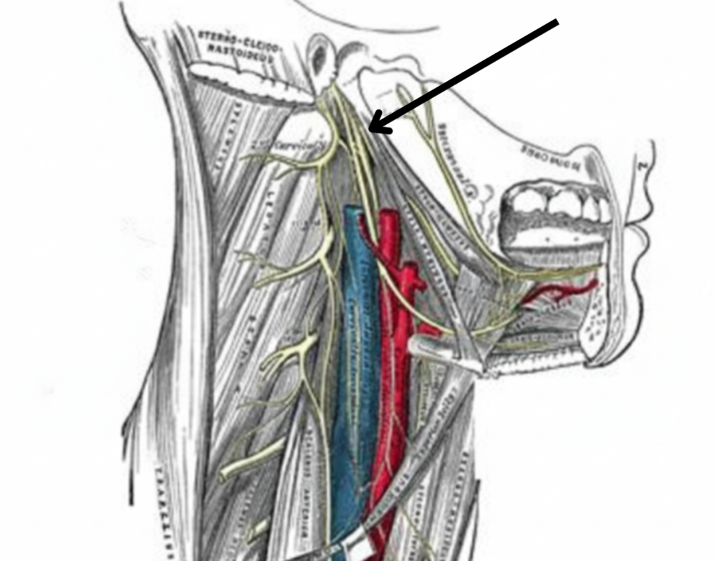 term image