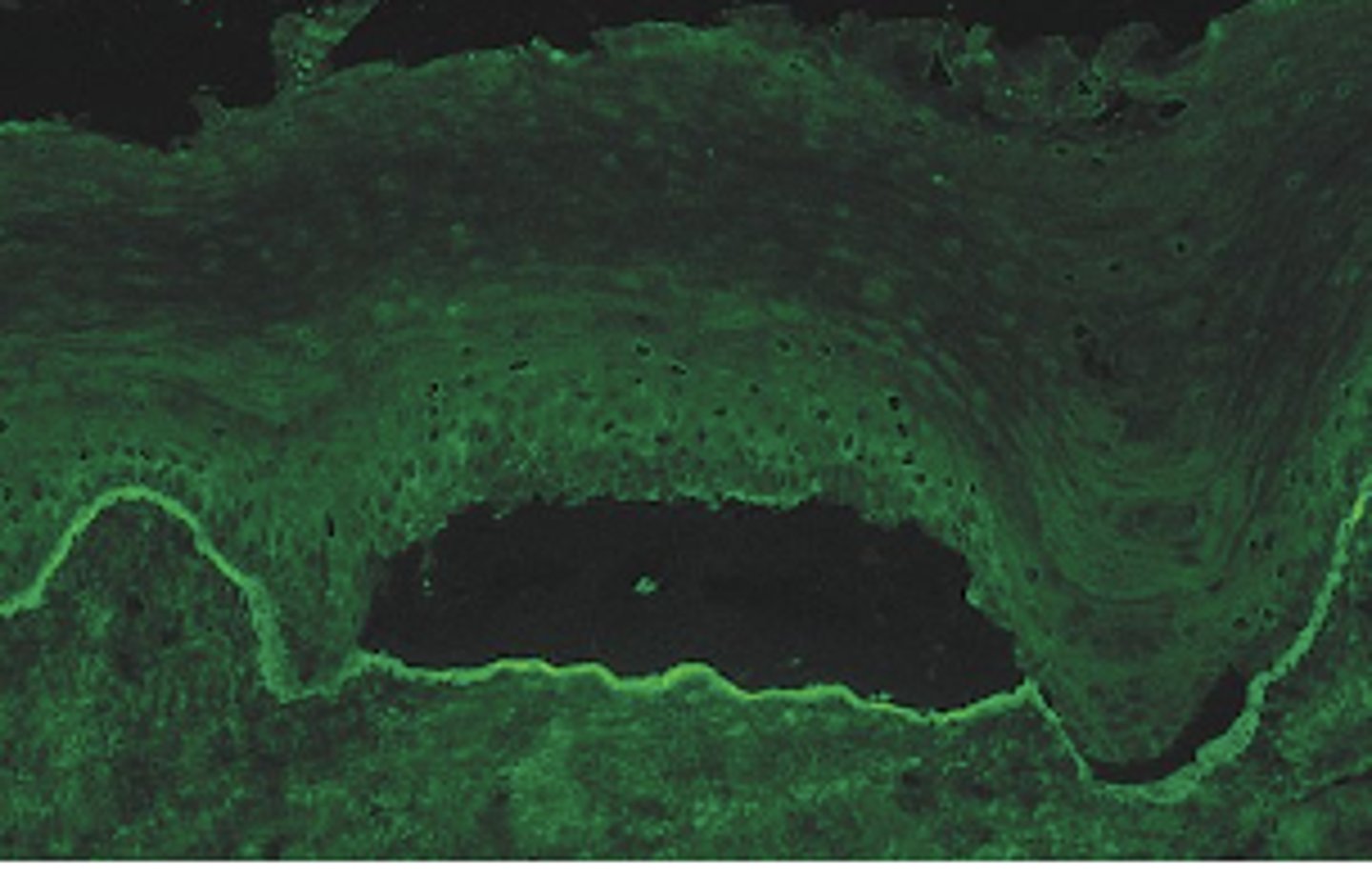 <p>What cell layer is affected in pemphigoiD?</p>