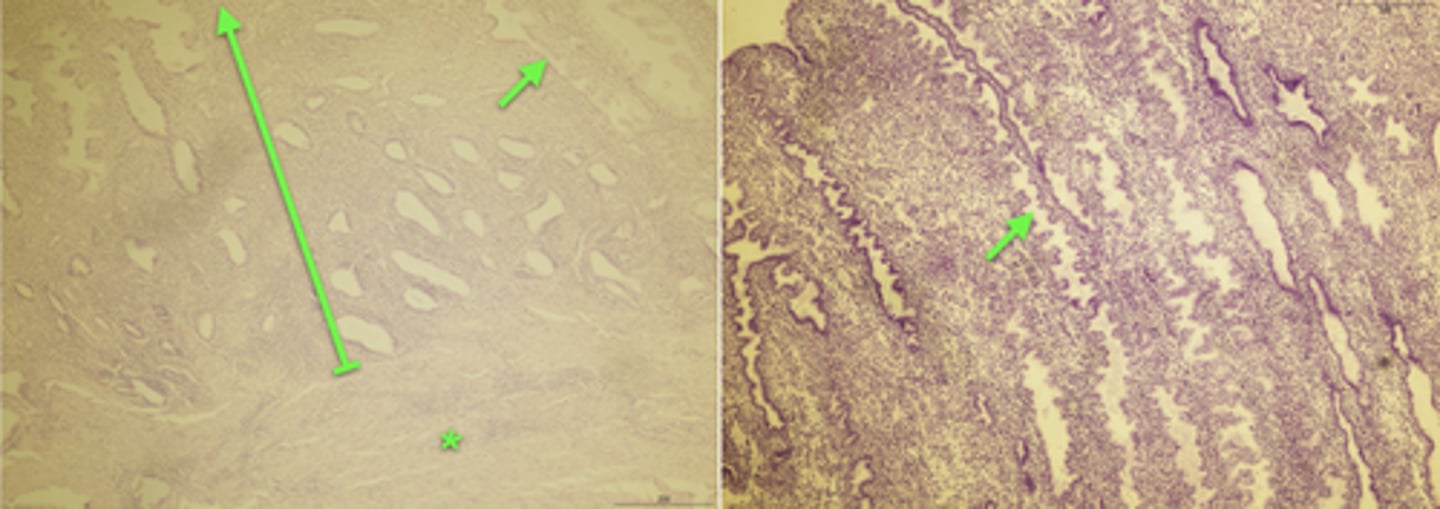 <p>(bracket on left image, and entire right image)</p>