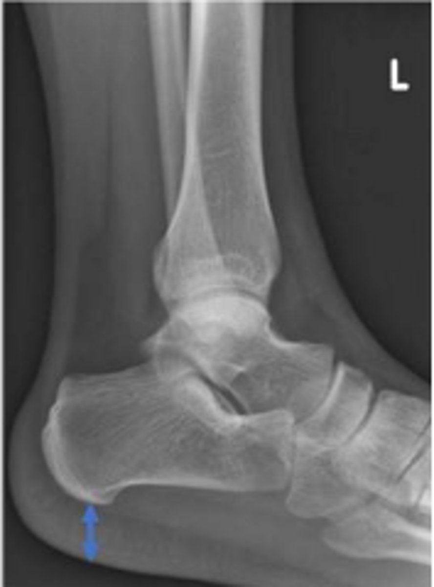 <p>What is the name of the assessment?</p>