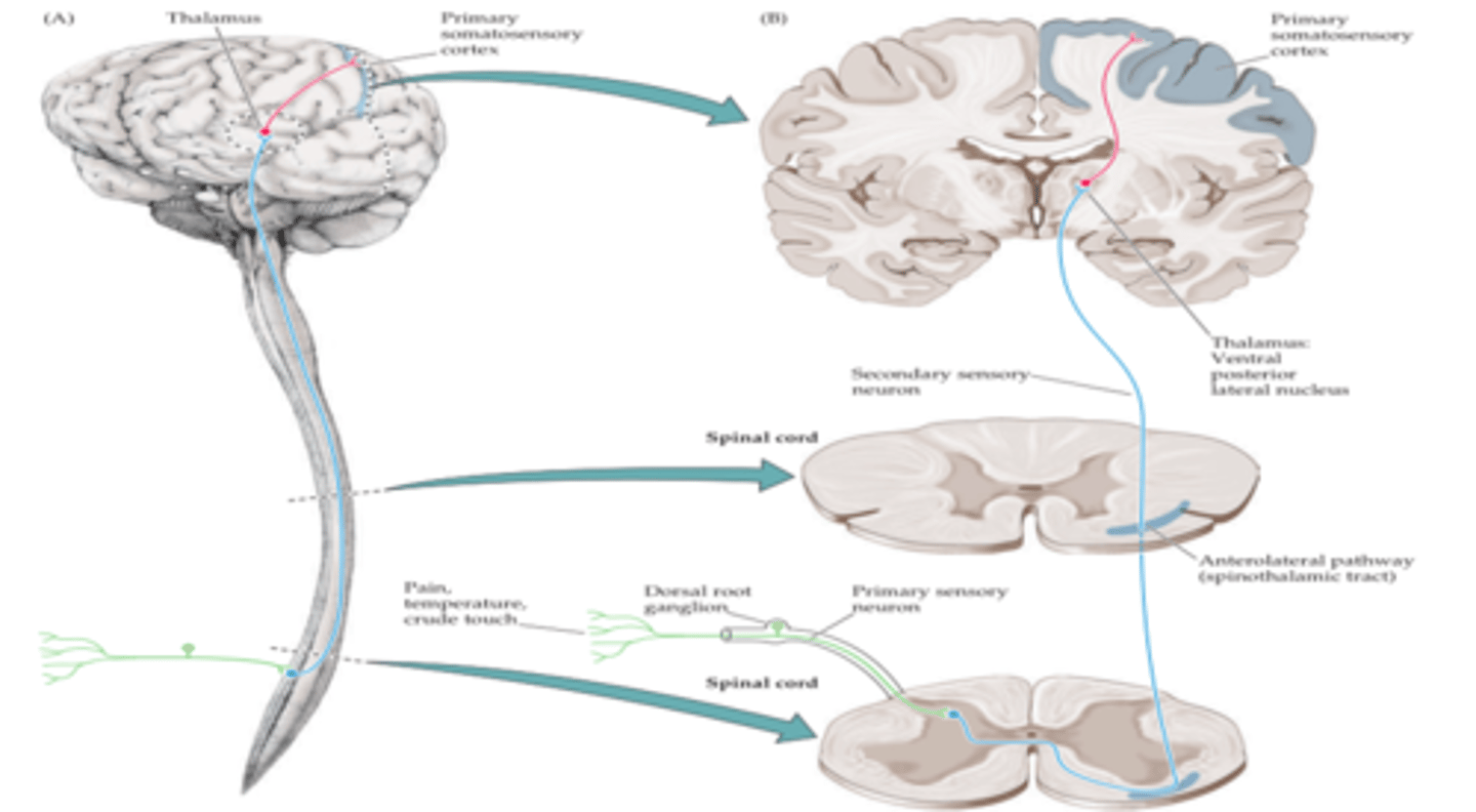 <p>It immediately decussates, and then ascends contralaterally to the medulla.</p>