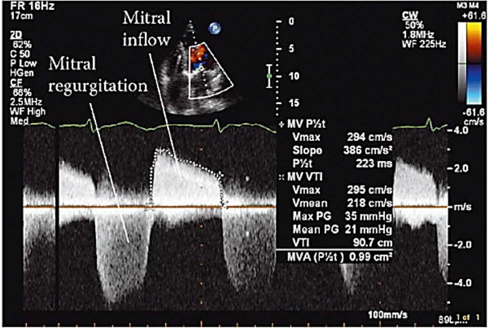 <p>Pressure Half Time</p>