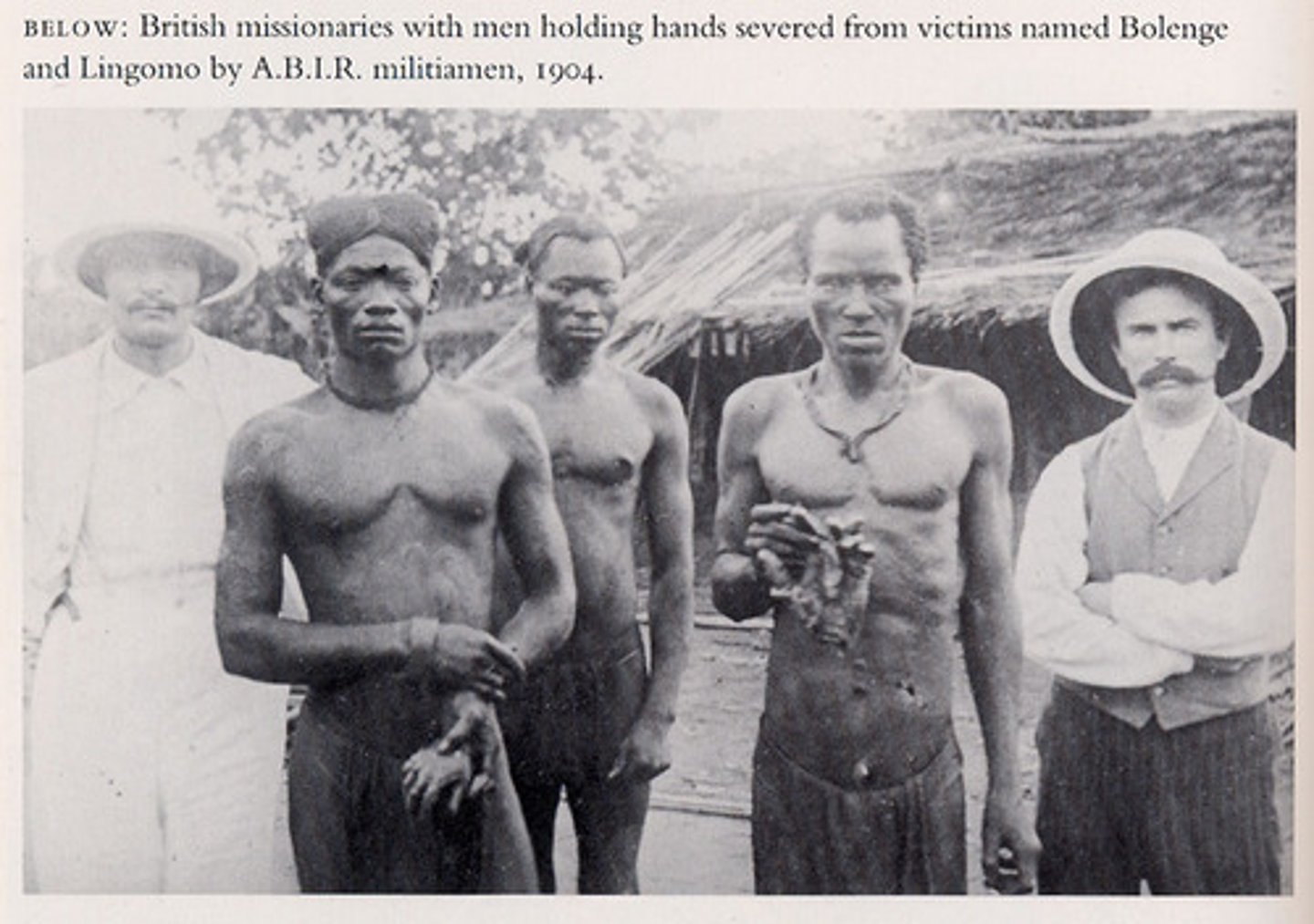 <p>a large area in Central Africa that was privately controlled by Leopold II of Belgium. He was able to secretly treat the people of the colony very badly until he was forced to give it up.</p>