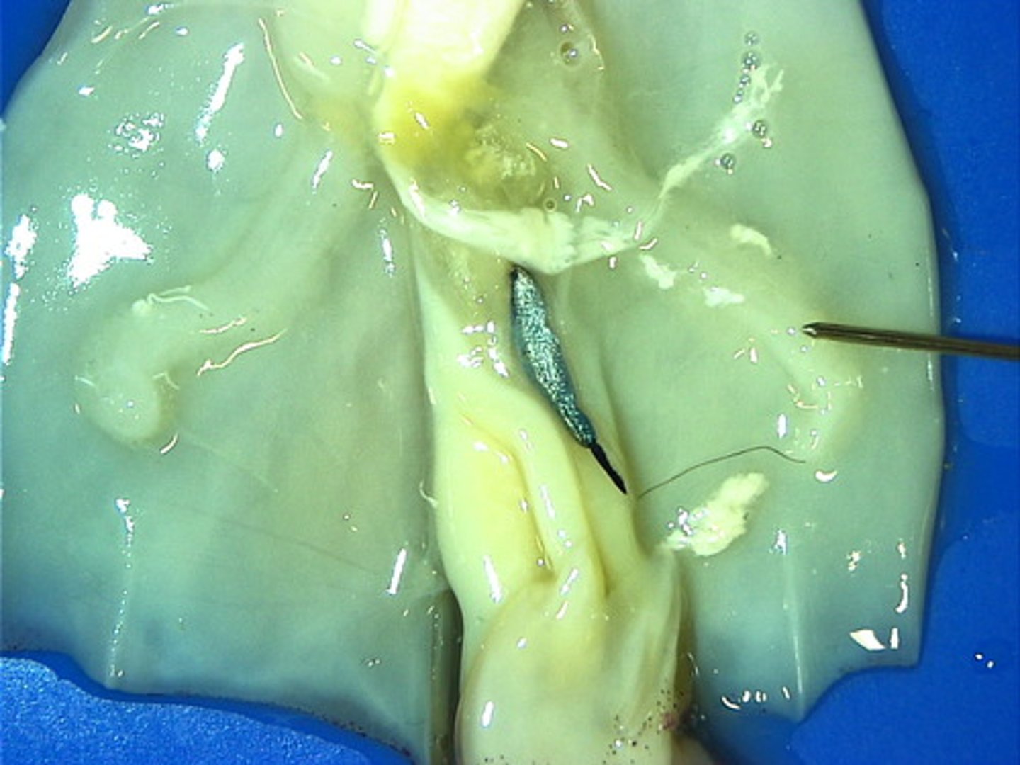 <p>Absorb oxygen from water. These are feathery-like structures that are used to absorb oxygen from water.</p>