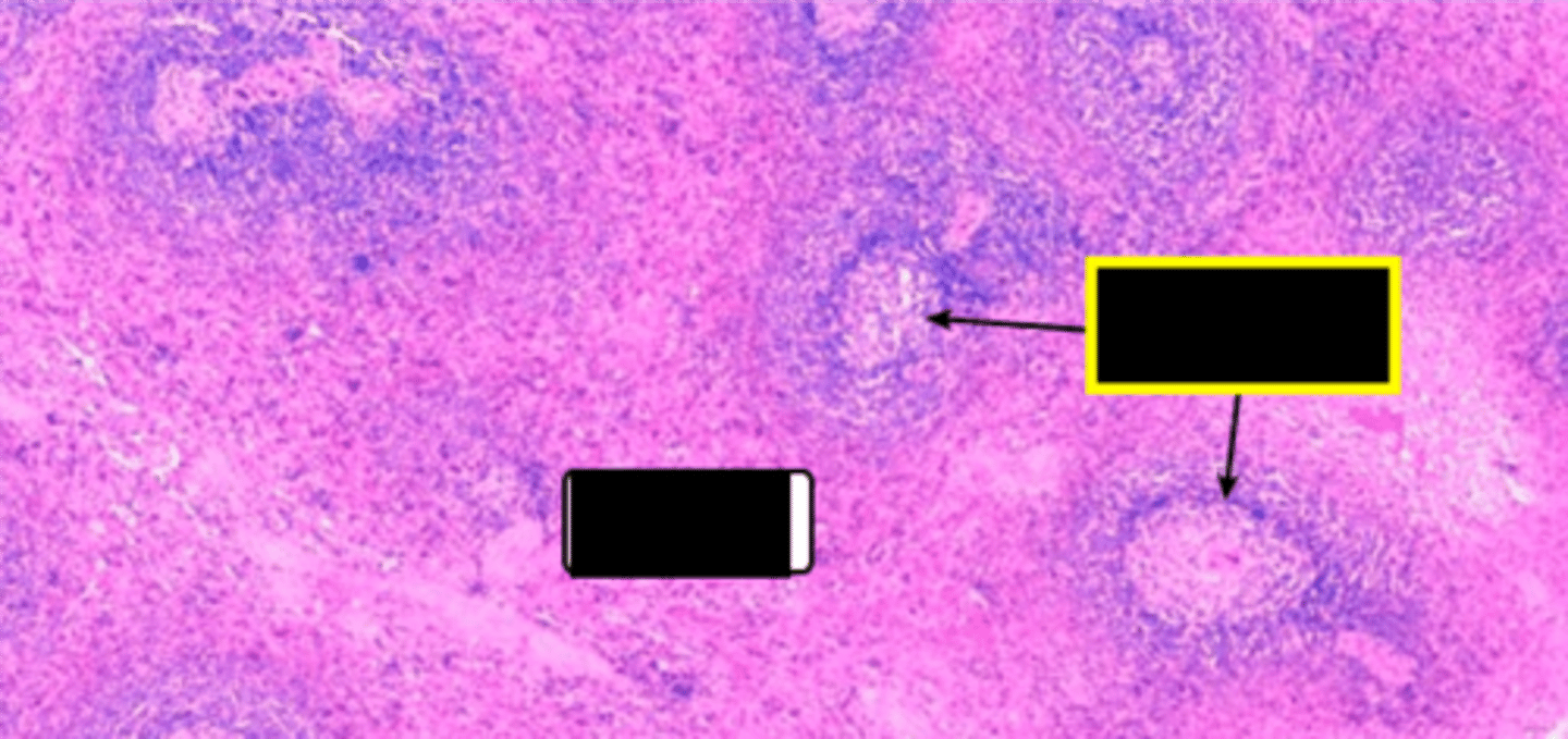 <p>Contains lymphocytes for immune response.</p>