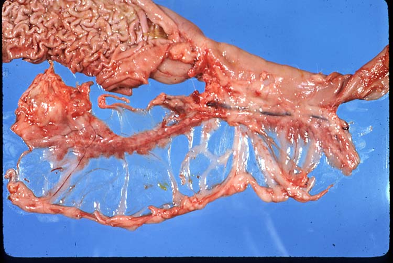 <p>What organ is this? Give a morphological description, morphological diagnosis, and possible etiology</p>