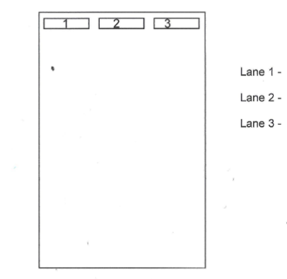 <p>What are each of the 3 gel lanes used to detect in PCR gel electrophoresis?</p>